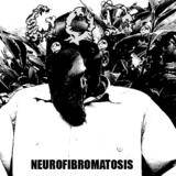 GOD (CAN-1) : Neurofibromatosis